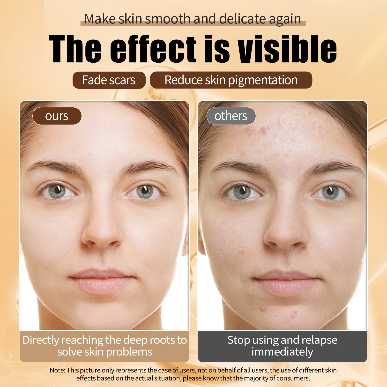 BELLTRA Repairing Snail Face Cream Snail Moisturizer Whitening Anti Aging Blemishes Fine Lines Pores Shrink Snail Mucin Cream