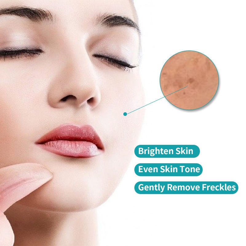 Brightening Whitening Dark Spot Corrector Remover Freckle Remove Face Cream For Dark Spot In Face