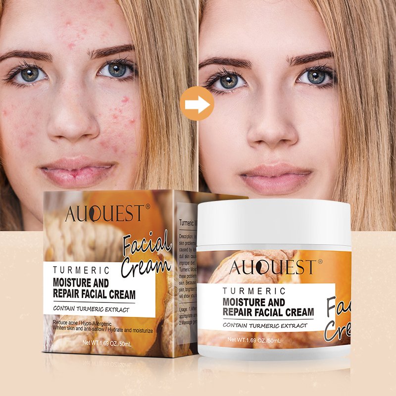 Hot selling Turmeric face cream Private label organic Lightening Anti Acne Dark Spot Whitening Moisturizer Face Cream