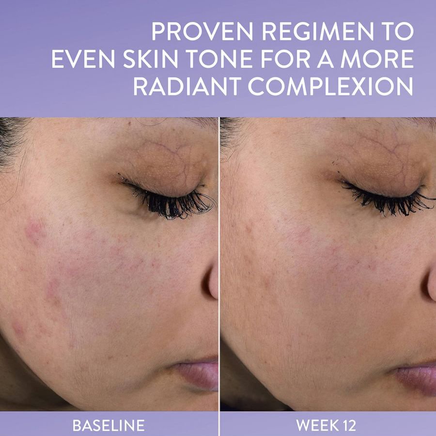 PRESSURE SORE RELIEF HEALING CREAM 50mL Facial Cream Moisturizer Relieve Redness Repair Skin Barrier Reapring Face Cream
