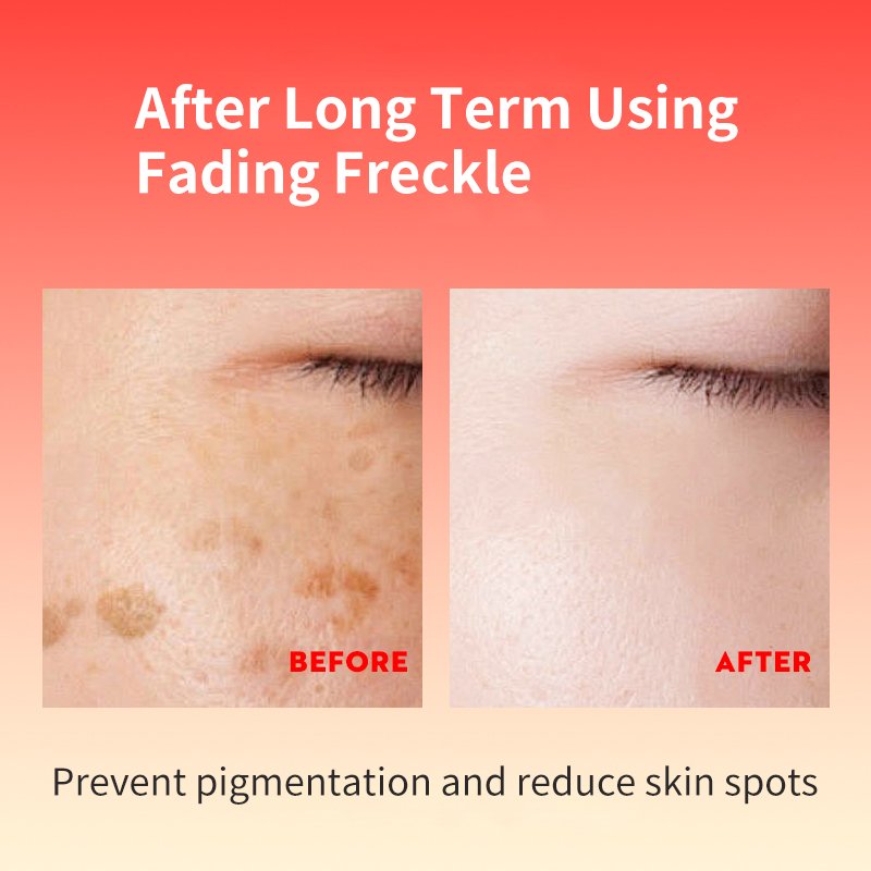 TWG Nicotinamide Anti Spots Face Cream and Lotion Effective Spot Removing Whitening Fade Dark Spot Anti Freckle Cream