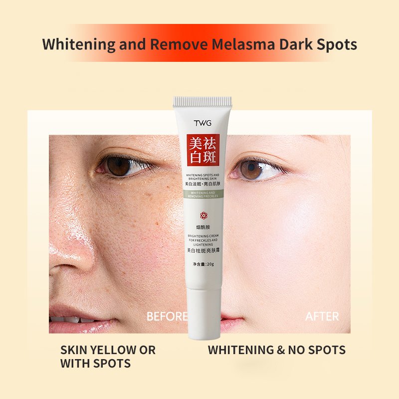 TWG Nicotinamide Anti Spots Face Cream and Lotion Effective Spot Removing Whitening Fade Dark Spot Anti Freckle Cream