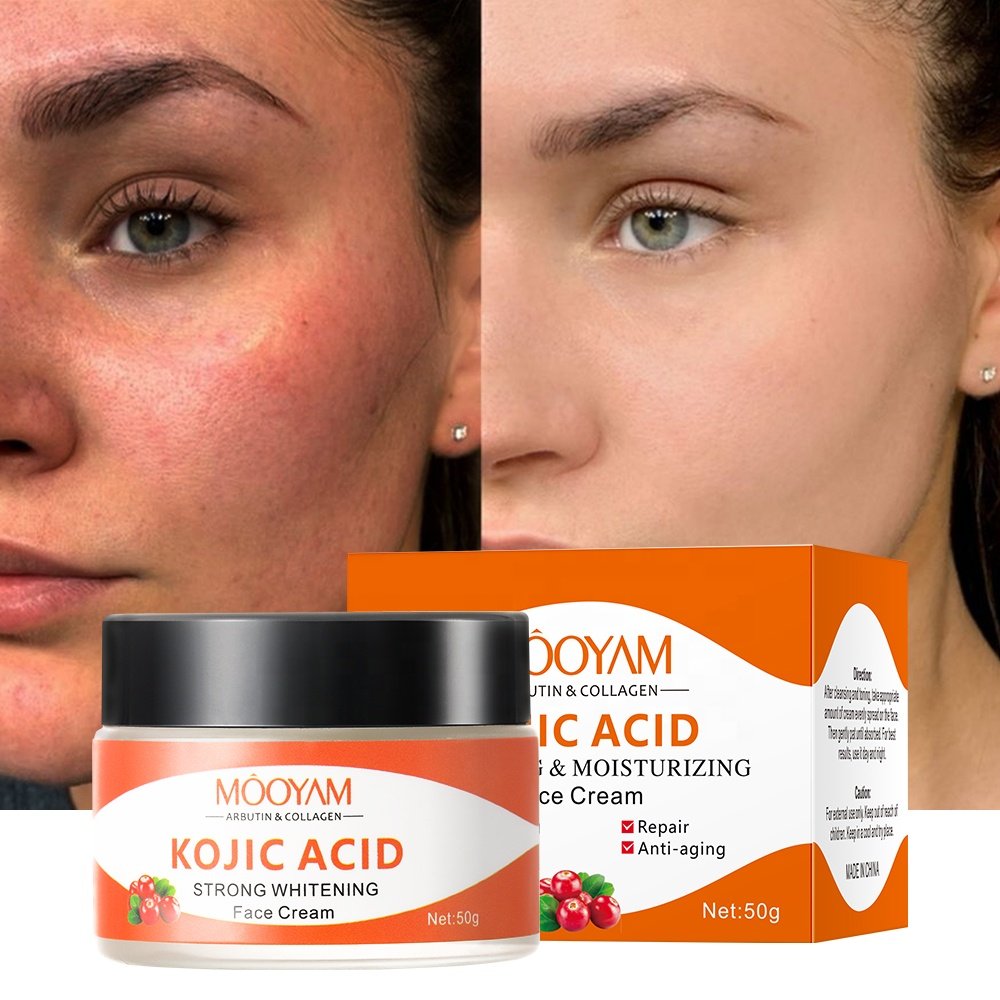 Anti Aging skin care face cream kojic acid Arbutin collagen face whitening cream skin lightening cream