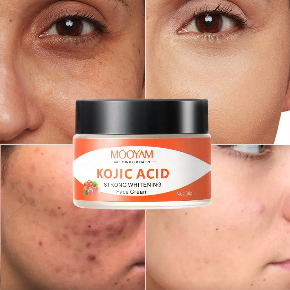 Anti Aging skin care face cream kojic acid Arbutin collagen face whitening cream skin lightening cream