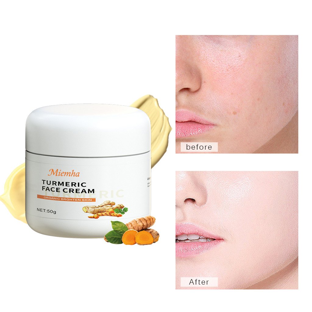Wholesale Acne Treatment Moisturizer Facial Turmeric Lotion Skincare Whitening Dark Spot Removal Turmeric Face Cream