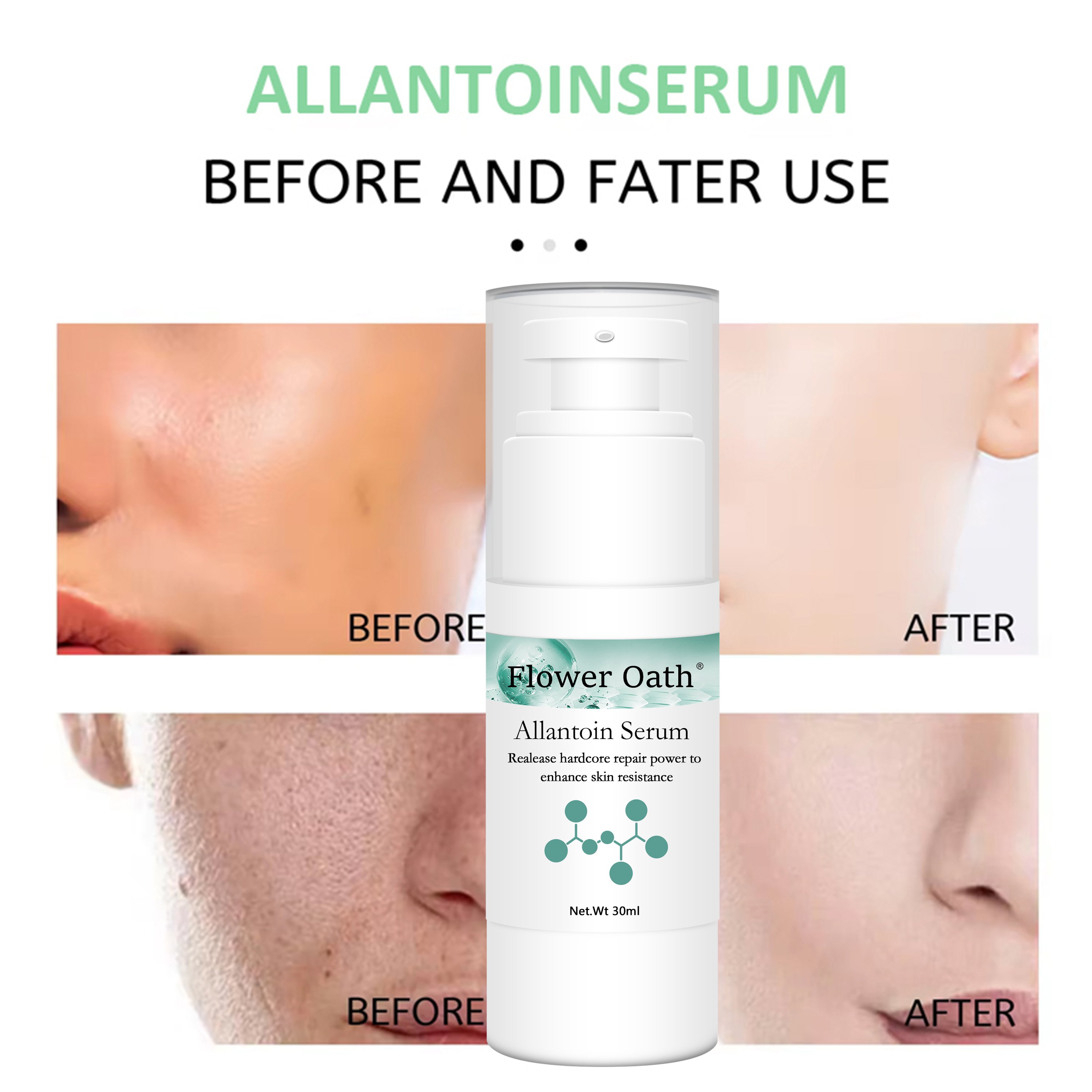 OEM ODM Serum Cream Lifting And Tightening Wrinkle Essences Repair Moisturizing Skin Care Serum Caviar Essence Face Cream B5