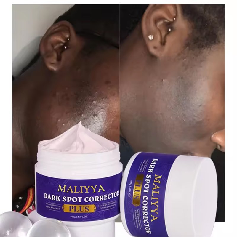 Custom Logo Moisturizing Brightening Skin Refreshing Concealer Freckle Removing Whitening Dark Spot Corrector Face Cream