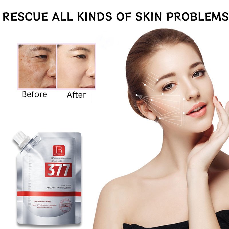 Whitening Face Cream & Lotion Freckle Removing and Wrinkle Resisting Essence Milk Lightens Spots and Tightens Skin