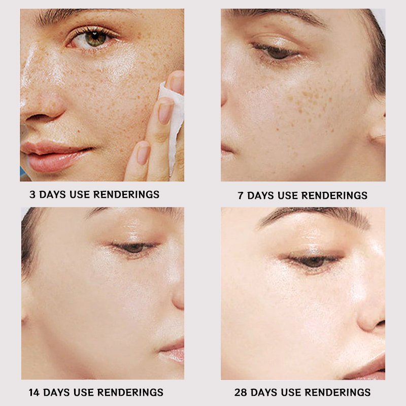 Whitening Face Cream & Lotion Freckle Removing and Wrinkle Resisting Essence Milk Lightens Spots and Tightens Skin