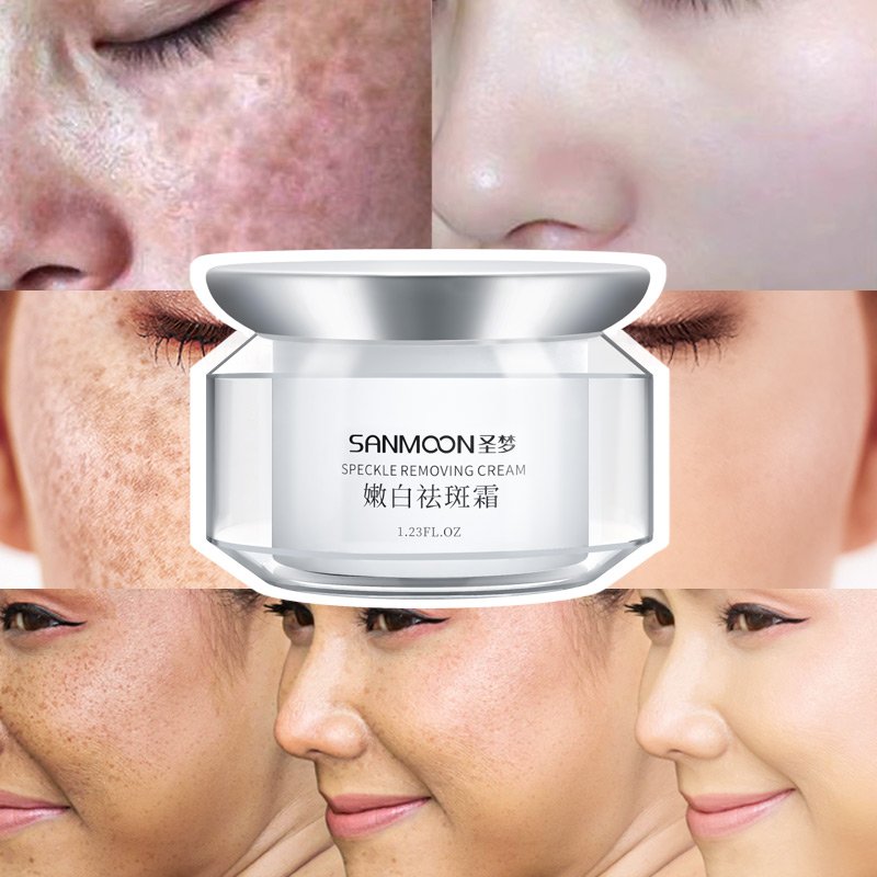 Whitening Face Cream Remove Dark Spots Whitening Anti Freckle Super Effective Cream