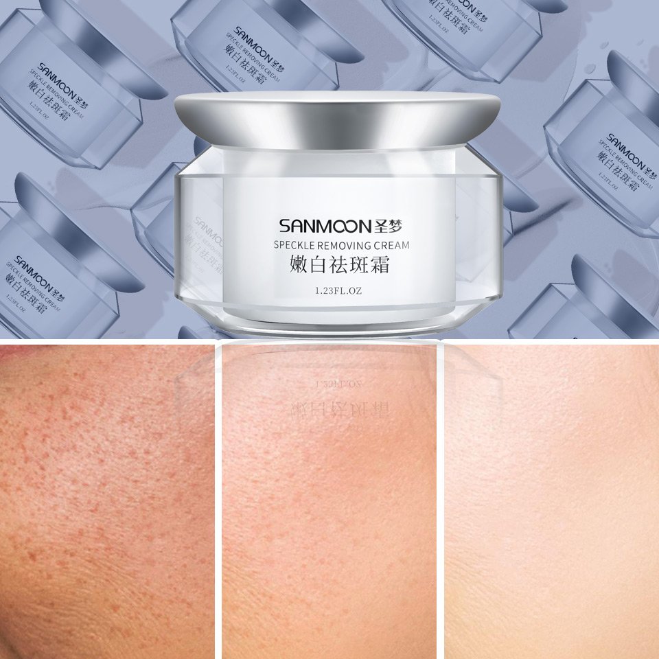 Whitening Face Cream Remove Dark Spots Whitening Anti Freckle Super Effective Cream
