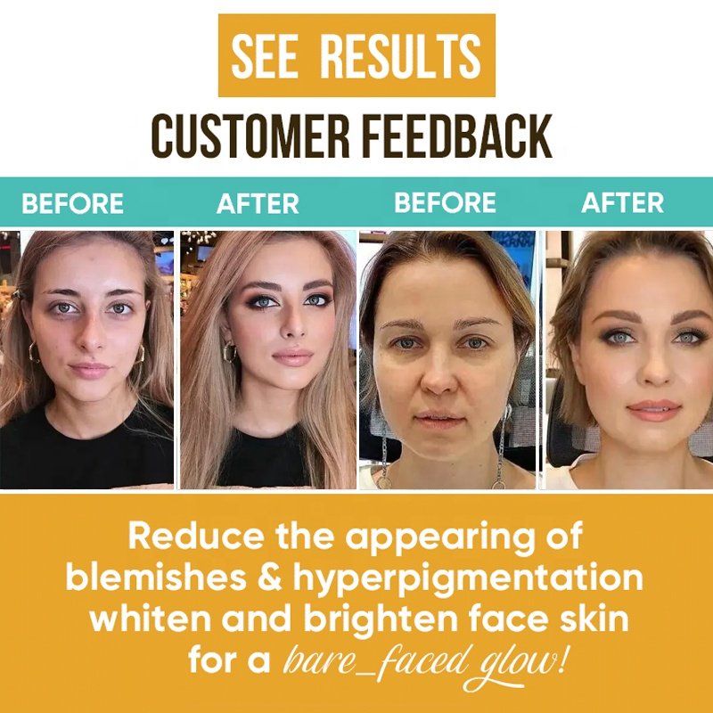 private label whitening acne cosmetic set turmeric soap turmeric serum lotion skin care set