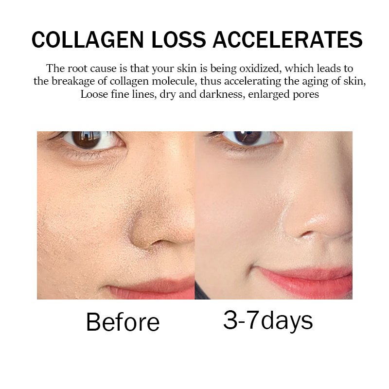 Collagen Face Cream pimple remover Niacinamide Centella Shea Butter Salicylic Acid Vitamin E cream for pimples