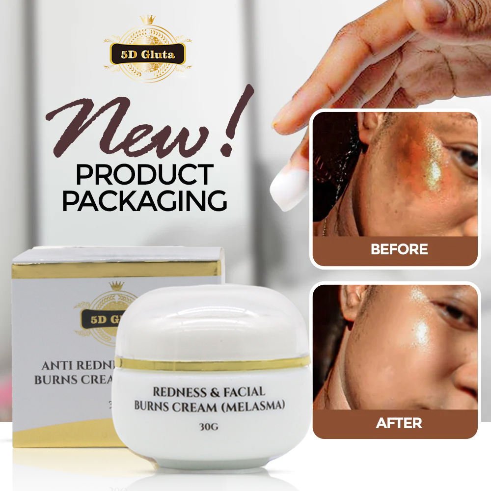 Private Label Relieve Sun burn Moisturizing Anti Redness Facial Burns Cream Hyperpigmentation Treatment Skin Repair Face Cream
