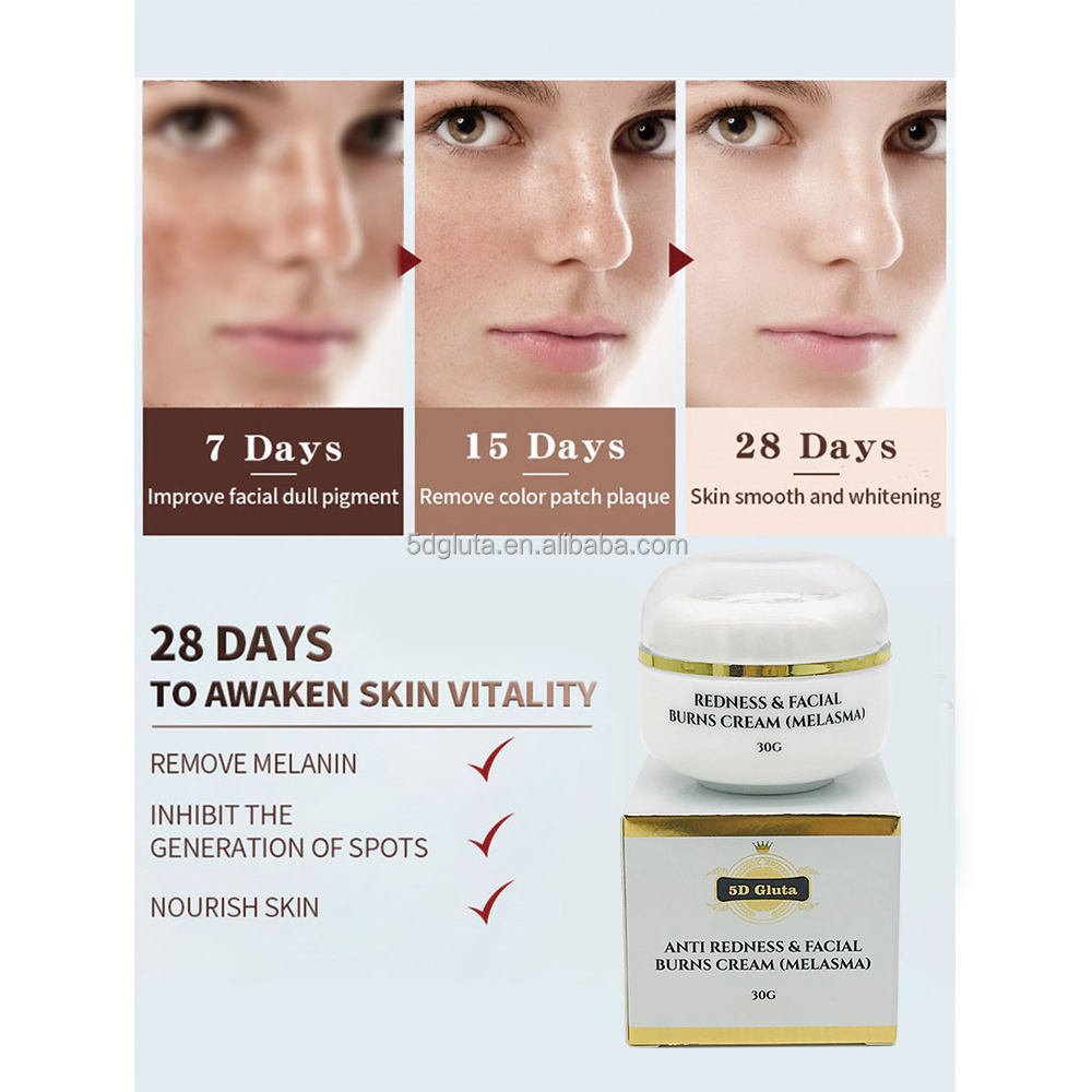 Private Label Relieve Sun burn Moisturizing Anti Redness Facial Burns Cream Hyperpigmentation Treatment Skin Repair Face Cream