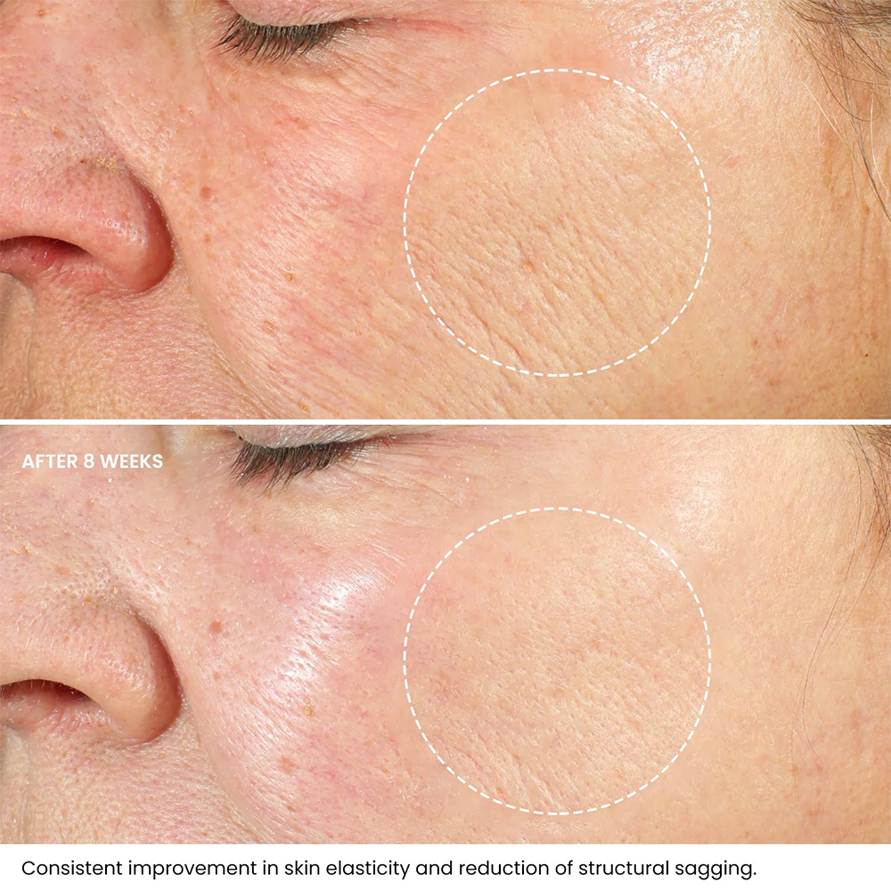 Retinol Collagen Anti-aging Cream Moisturizing Face Cream To Firming Skin And Reducing Wrinkles best anti aging face cream