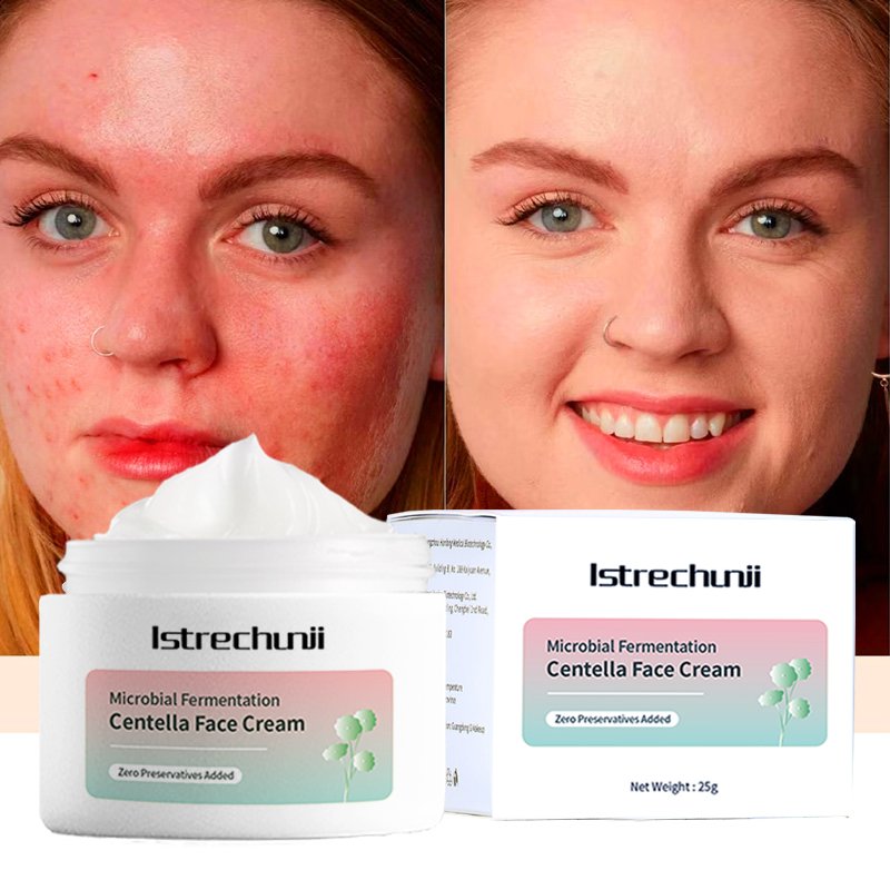 Customized Skincare Soothing & Calming Skin Strengthening Skin Repairing Skin Soothing Centella Asiatica Face Cream
