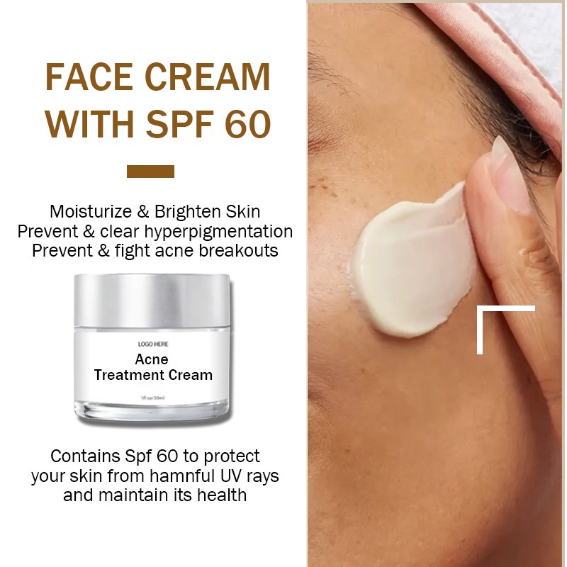 Acne treatment cream Removal 7 Days Dark Spot Corrector Skin Care Private Label Whitening Freckle Face Cream