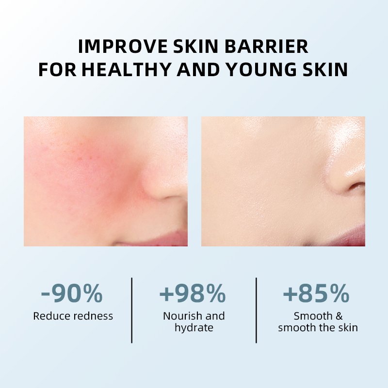 Biosphere Private Label 7X Ceramide Barrier Repair Skin Care Cream Tightening Whitening Repair Face Cream