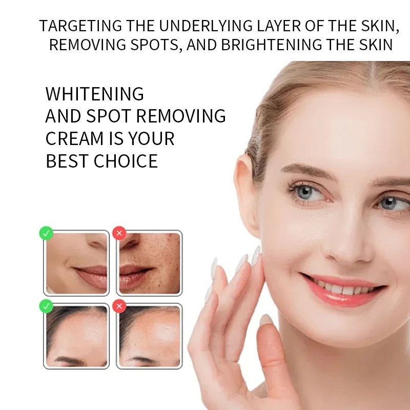 Private Label Facial Cream Skin Whitening Dark Spot Removing Whitening Face Cream