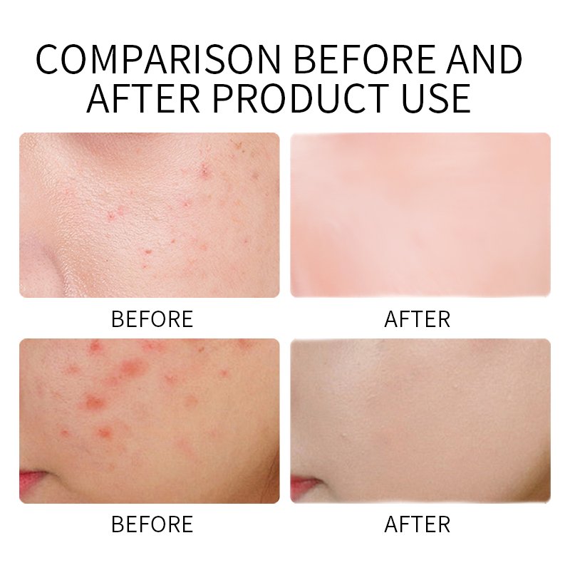Private Label Facial Cream Skin Whitening Dark Spot Removing Whitening Face Cream