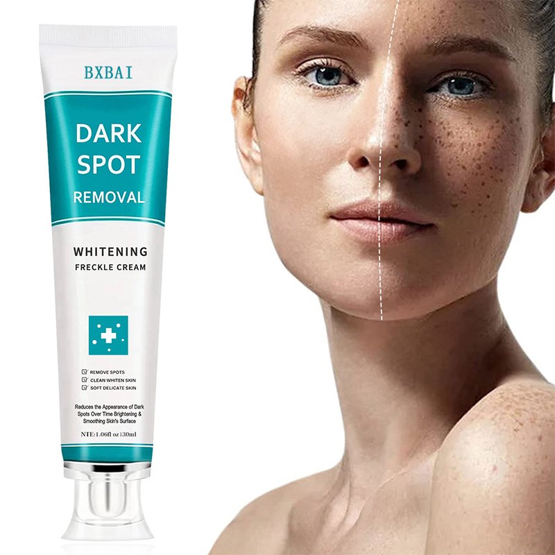 7 Days Powerful Face Cream & Lotion Dark Spot Removal & Anti-Freckle Whitening Stronger than Ever!