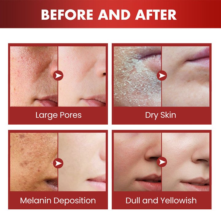 Women Face Cream Natural Anti Ageing Luxury Moisterizer Cream Day And Night All In One Moisturising Cream For Sensitive Skin