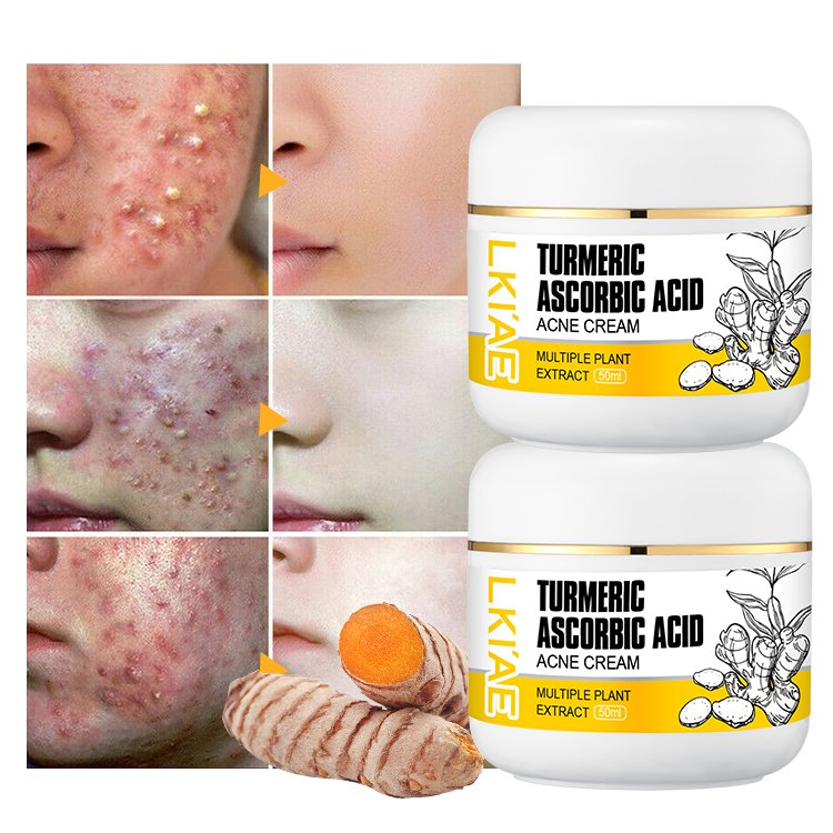 Best Selling Black Skin Care Facial Cream Anti Acne Dark Spot Remover Moisturizing Brightening Turmeric Face Cream For Daily Use