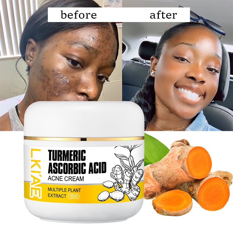 Best Selling Black Skin Care Facial Cream Anti Acne Dark Spot Remover Moisturizing Brightening Turmeric Face Cream For Daily Use