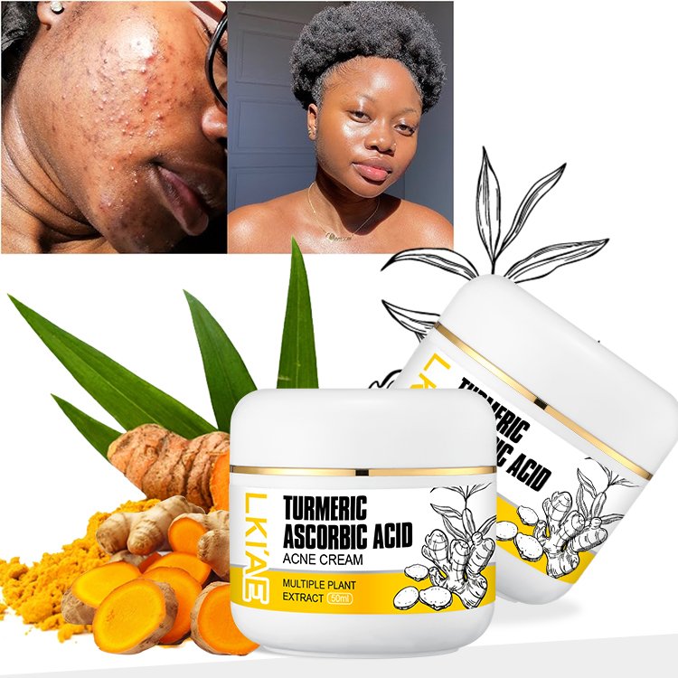 Best Selling Black Skin Care Facial Cream Anti Acne Dark Spot Remover Moisturizing Brightening Turmeric Face Cream For Daily Use