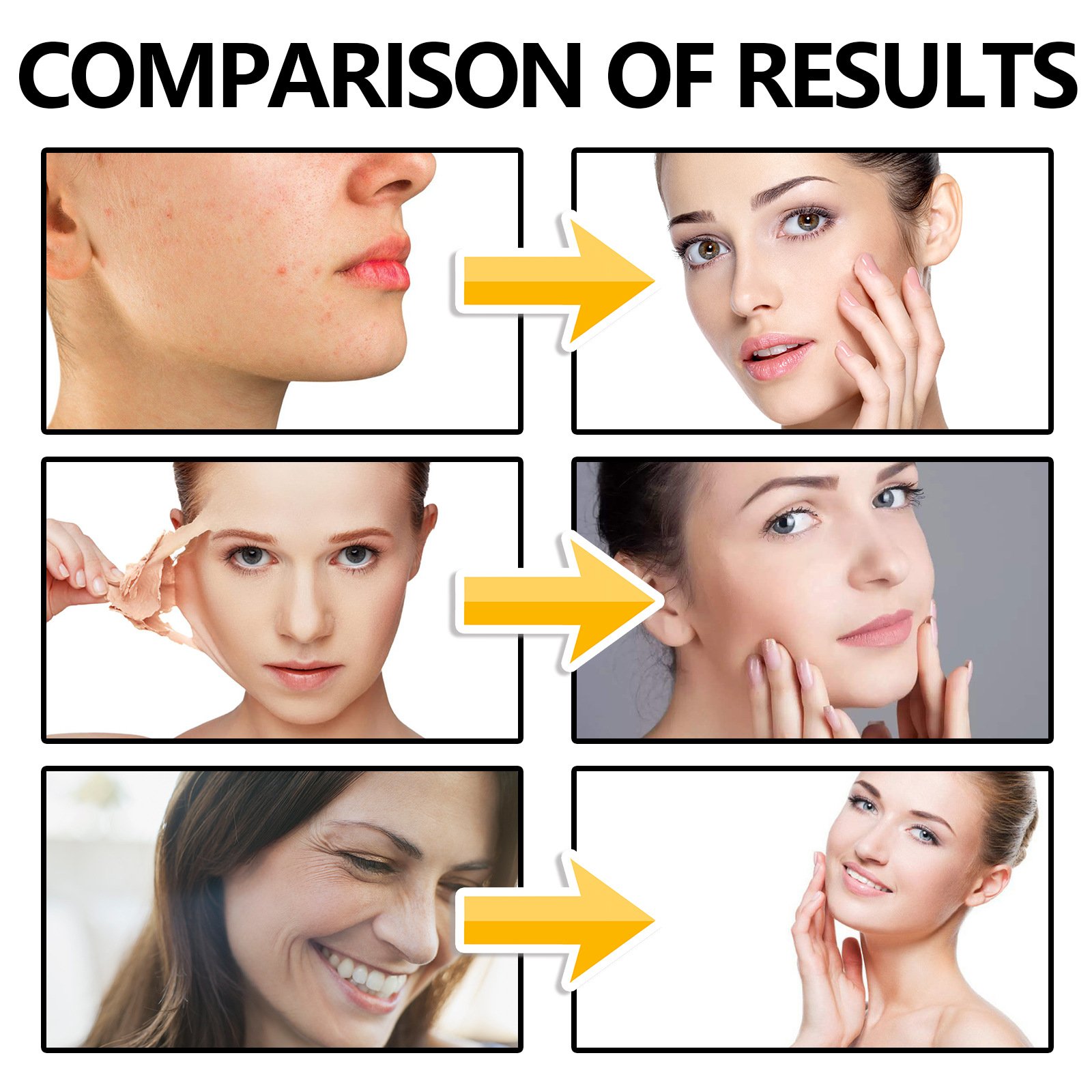 hot selling Glow Rejuvenator Luminous Cream Spot Terminator Purifying vitamin C face cream