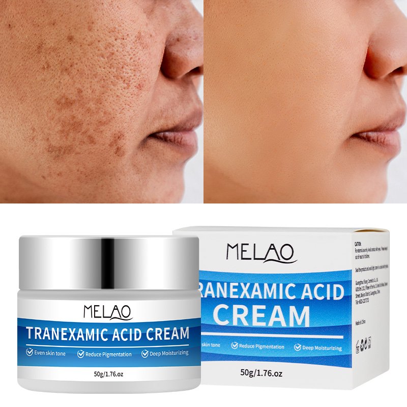 Day & Night Dark Spot Remove Face Cream Moisturizing Redness Relief Brightening Tranexamic Acid Discolor Correcting Face Cream