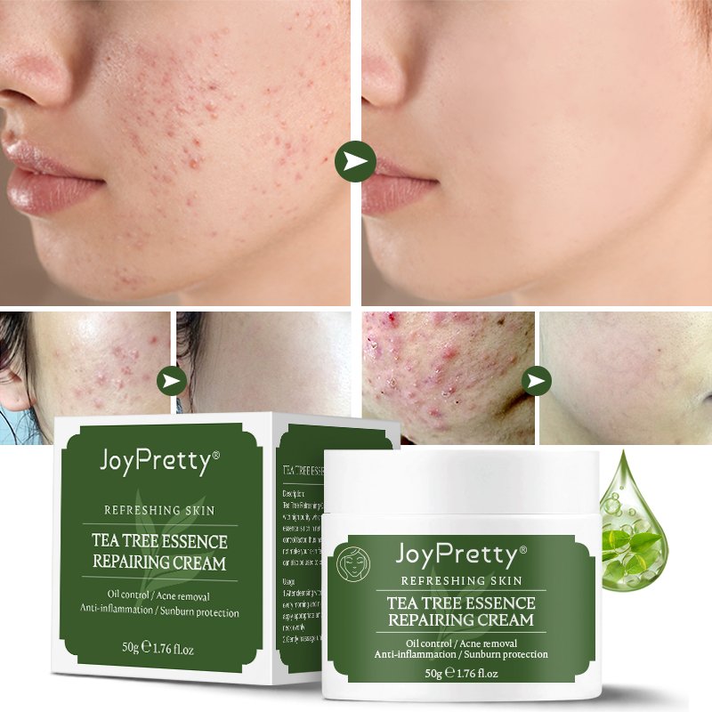 JoyPretty Tea tree face cream hot sale organic Moisturizer Oil Control Smooth Repair Anti Acne Dark Spot Removing face cream