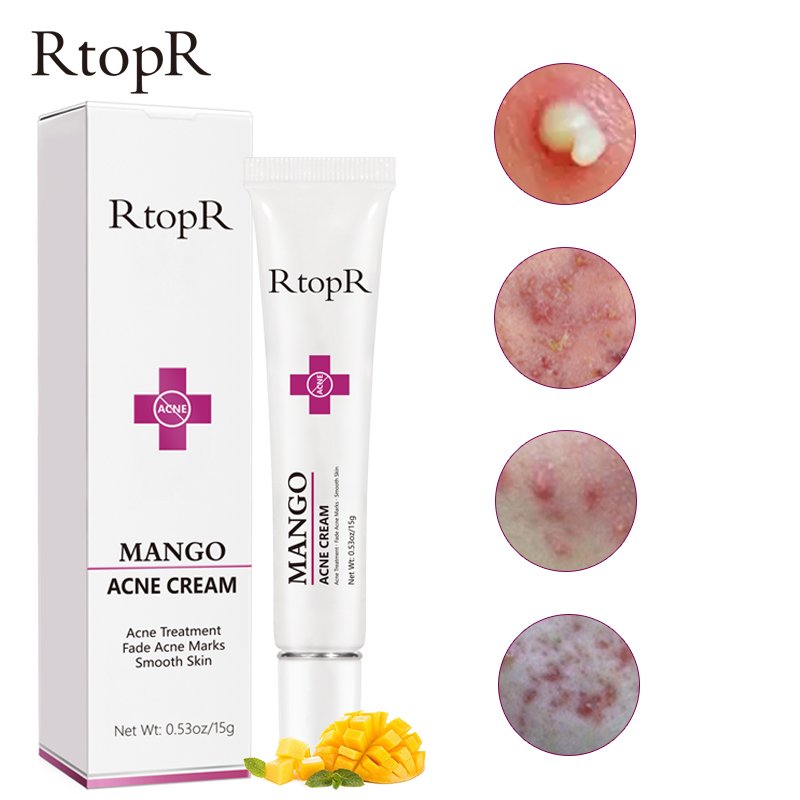 Mango Acne Removal Face Cream Whitening Oil Control Beauty Skin Care Shrinks Pore Moisturizing Brighten Korean Cosmetics