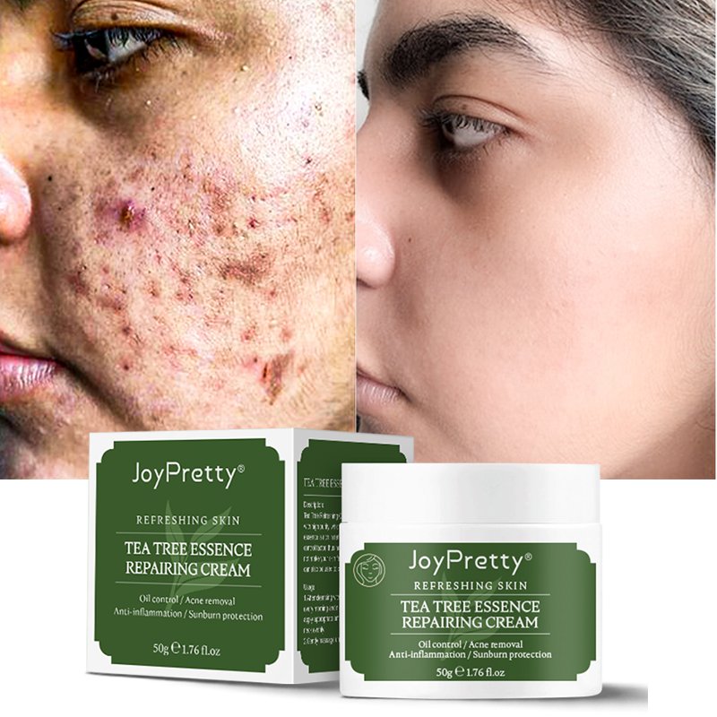 JoyPretty Tea tree face cream private label organic Moisturizer Nourishing Dark Spot Remover Whitening face cream