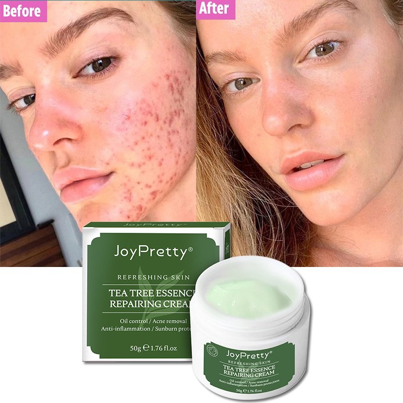 JoyPretty Tea tree face cream private label organic Moisturizer Nourishing Dark Spot Remover Whitening face cream