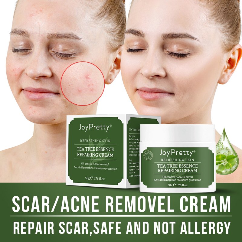 JoyPretty Tea tree face cream private label organic Moisturizer Nourishing Dark Spot Remover Whitening face cream