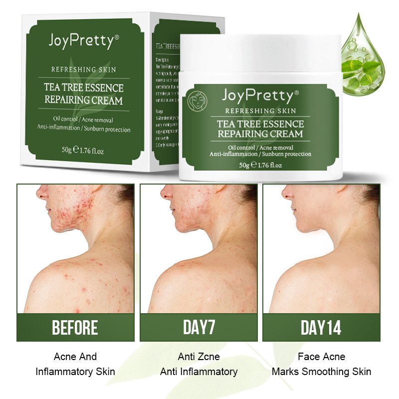 JoyPretty Tea tree face cream private label organic Moisturizer Nourishing Dark Spot Remover Whitening face cream