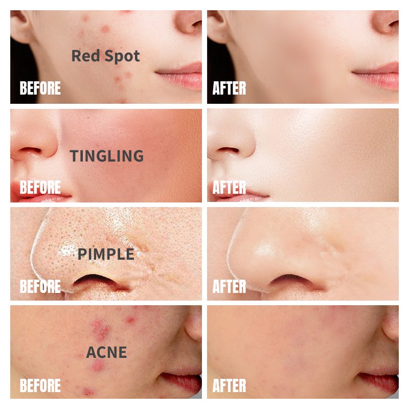 Custom Logo Private Label Skincare Organic Vegan Anti Allergy & Acne Redness Removing Soothing Face Cream For Home Use