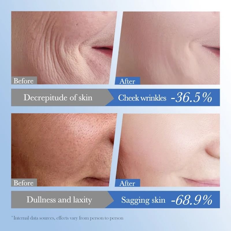 OEM SADOER New Arrival Caviar Moisturizing Repairing Anti-Wrinkle Hyaluronic Acid Face Cream For Women Anti Aging The Best One