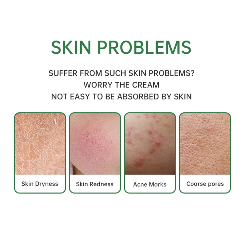 The Best Face Cream for Ladies Paraben-free Anti Acne & Moisturizing and Tea Tree & Purslane Green Face Paste Cream