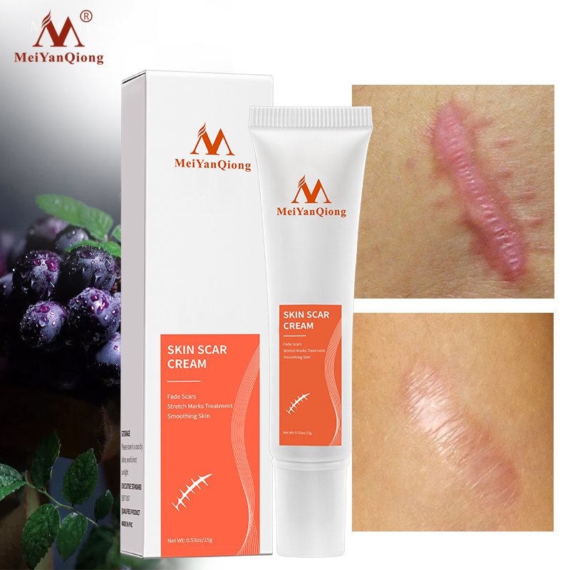 Acne Scar Removal Cream Skin Repair Face Cream Acne Spots Acne Treatment Blackhead Whitening Cream Anti Scar Stretch Marks 15g