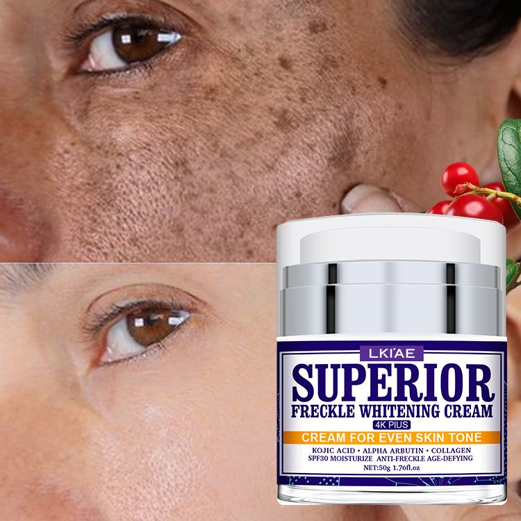 Private Label United States Remove Dark Spots Freckle removal Whitening Anti Aging Face Cream for Black skin