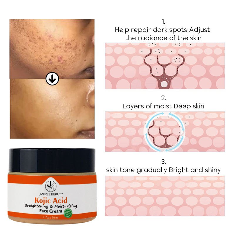 JMFREE Beauty Skin Care Dark Spot Removing Acne Skin Whitening Brightening Anti Aging Wrinkle Kojic Acid Face Cream