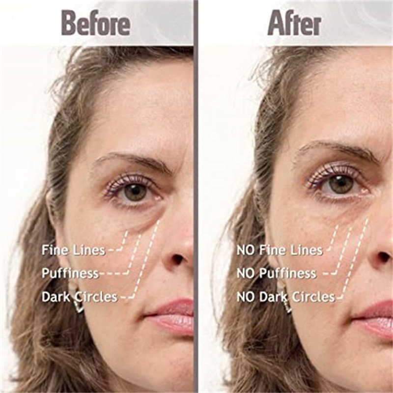 Best Facial Skincare Anti Aging Cream And Wrinkles Face Cream Hydrating Dark Spots Removal Face Bleaching Creams
