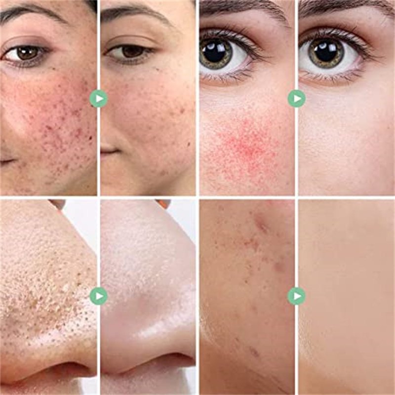 Best Facial Skincare Anti Aging Cream And Wrinkles Face Cream Hydrating Dark Spots Removal Face Bleaching Creams