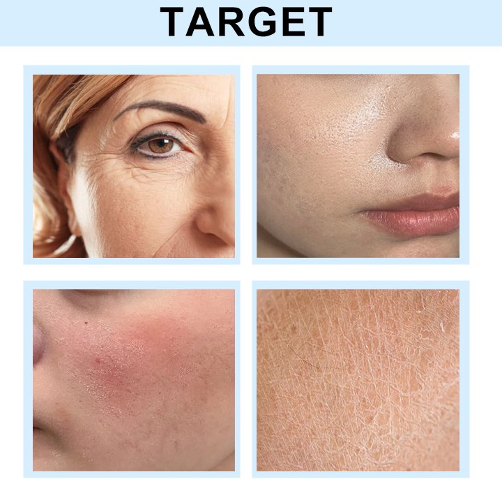 Hyaluronic Acid Cream Hyaluronic Acid Intense Hydrating Moisturizer Antiaging Anti Wrinkle Face Cream
