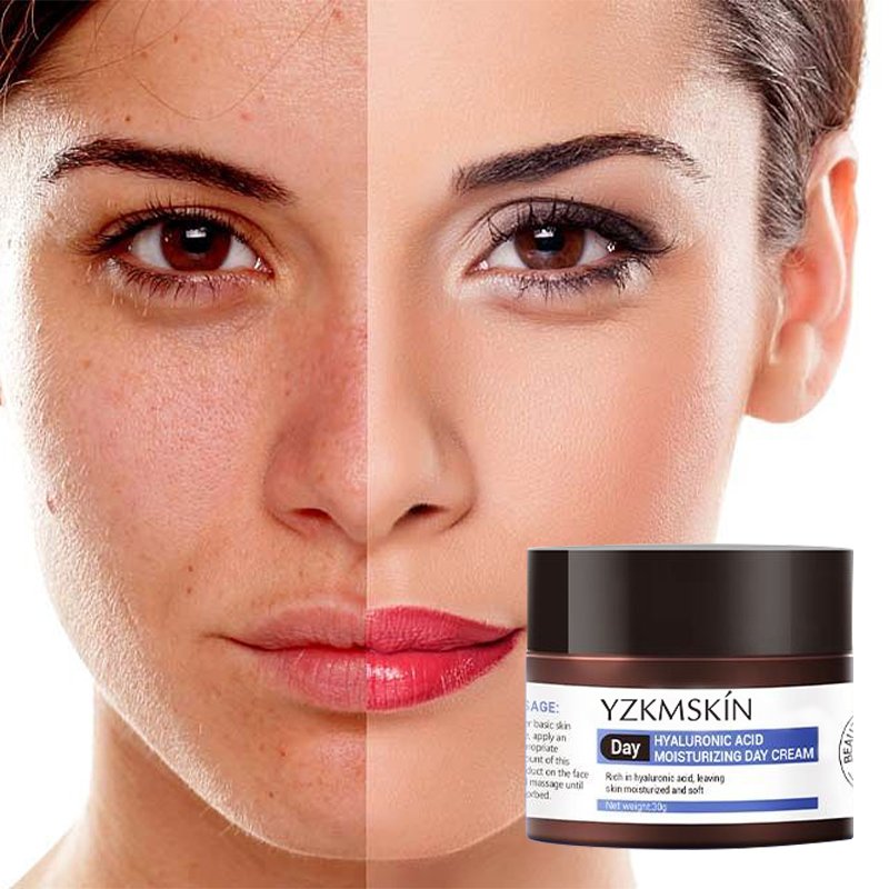 OEM Facial Anti-wrinkle Whitening Custom Logo Skin Care Products Anti-Aging Whitening Beauty Face Cream Day and Night Face Cream