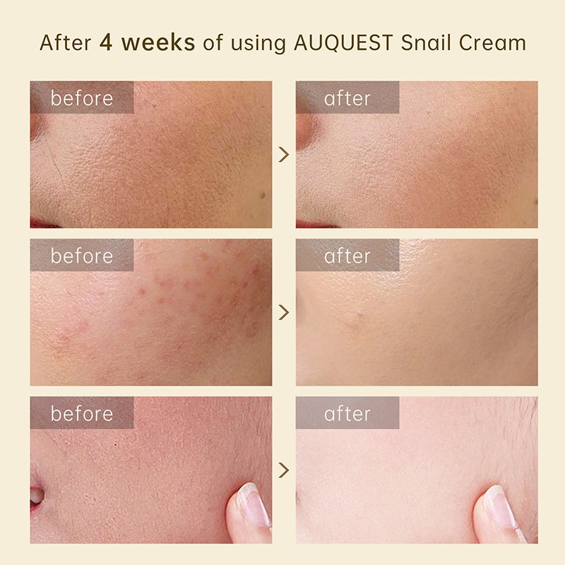 AuQuest snail cream Private label organic Moisturizing repairing collagen whitening Anti Wrinkle Snail face Cream
