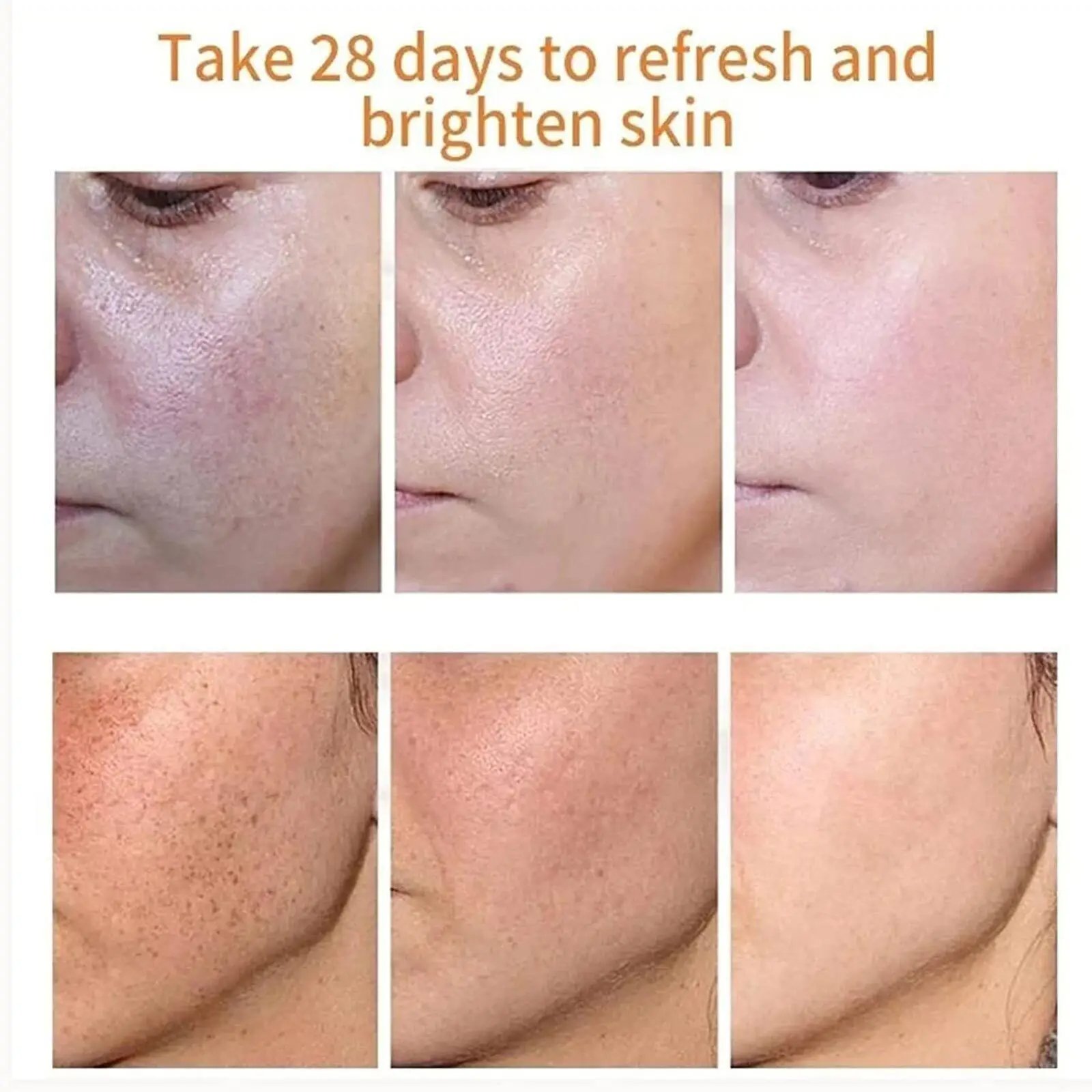 Yunnan Herbal Face Skin Care Whitening Anti Freckle Moisturizing Lightening Melasma Fade Spots Brightening Face Cream